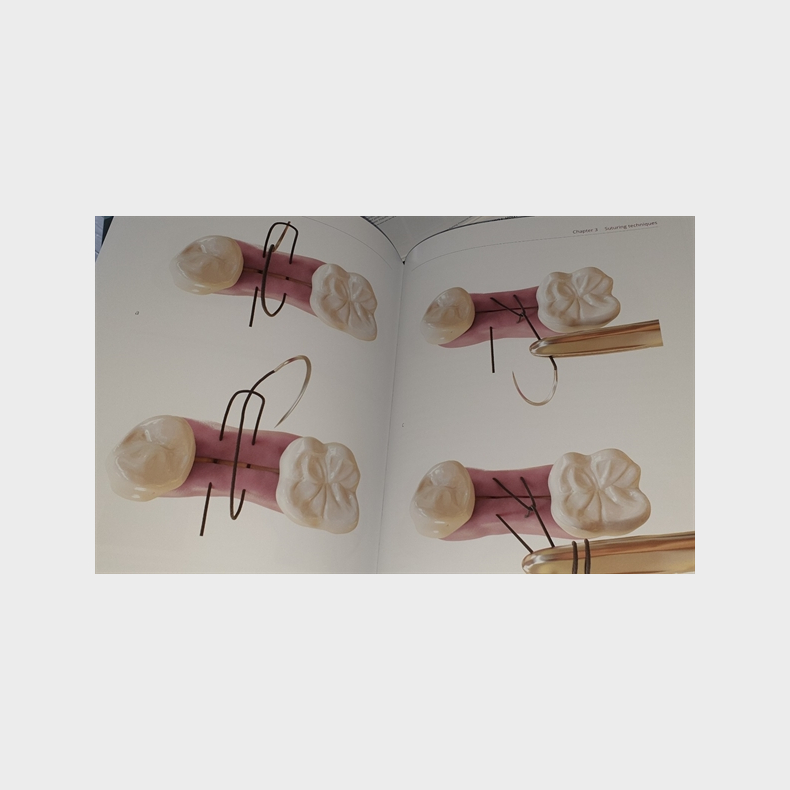 The Art of Dental Suturing - A Clinical Guide